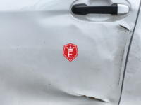 Bezinwazyjne usuwanie wgnieceń